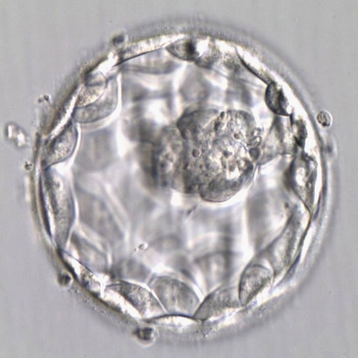 example_embryo.jpg